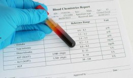 吃哈密瓜后血糖7,7值背后的健康启示